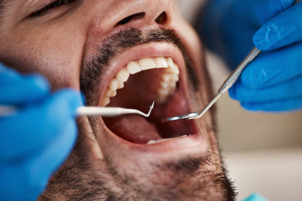 Best Emergency Tooth Extraction  in North Lewisburg, OH