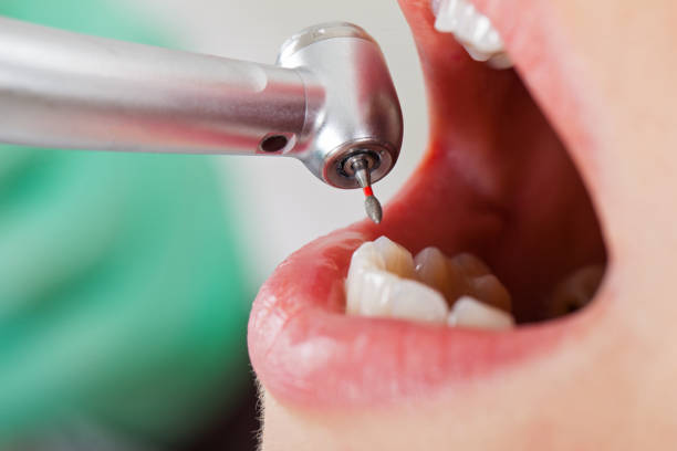 Best Dentist for Dental Trauma  in North Lewisburg, OH
